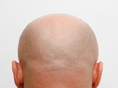 Back of a bald head, resembling a football, used humorously in an AI news quiz about a camera mistaking it for a football during a match.