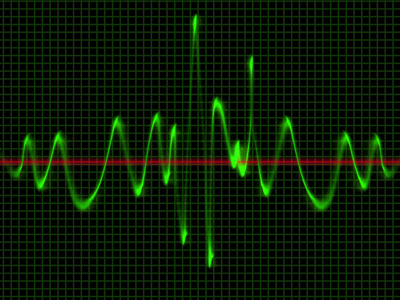 Waves - Properties of Waves 01