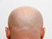 Back of a bald head, resembling a football, used humorously in an AI news quiz about a camera mistaking it for a football during a match.