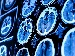 Close-up of medical brain scan images on a screen, showing detailed CT or MRI scans of the human brain in blue tones, representing AI use in healthcare diagnostics.